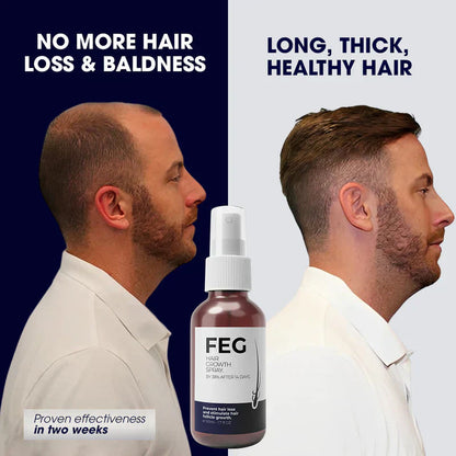 FEG Plus Hair Growth Serum Spray – (For Men and Women)