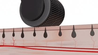 Original Derma Roller System For Hair & Face Treatment With 10 Sizes