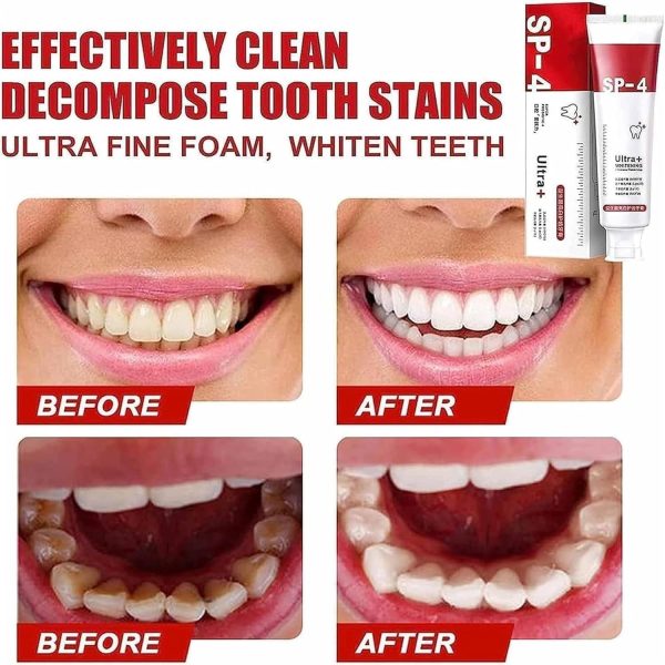 Yayashi SP-4 Ultra Whitening Toothpaste – Probiotic Stain Remover (120g)