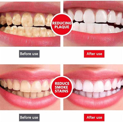 Yayashi SP-4 Ultra Whitening Toothpaste – Probiotic Stain Remover (120g)